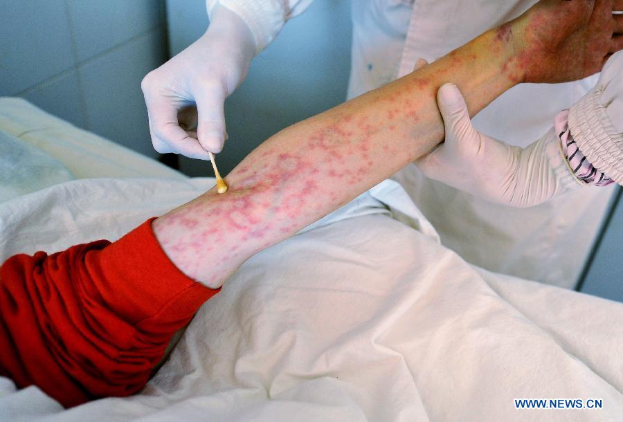 A doctor gives injection for a HIV/AIDS patient who is severely ill at the Yunnan HIV/AIDS Care Center in Anning City, southwest China's Yunnan Province, Dec. 1, 2012. (Xinhua/Lin Yiguang)