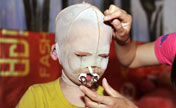 Photo story: Mask girl's hard life